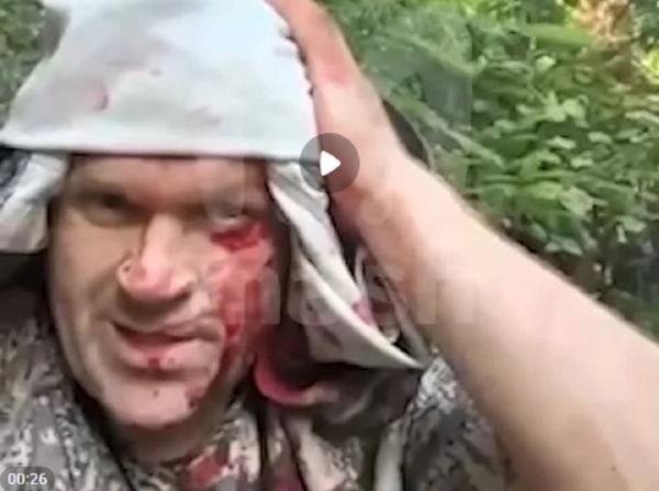 Повалил меня на землю. Под Новгородом медведь напал на мужчину (фото) Повалил меня на землю. Под Новгородом медведь напал на мужчину (фото)