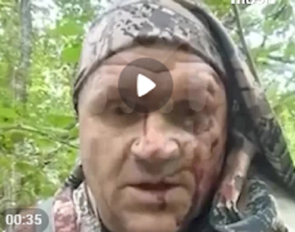 Повалил меня на землю. Под Новгородом медведь напал на мужчину (фото) Повалил меня на землю. Под Новгородом медведь напал на мужчину (фото)